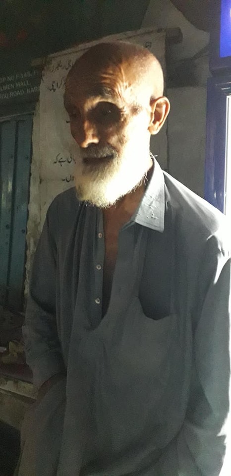 Hardworking Blind Man Lost Eyes In Bomb Blast